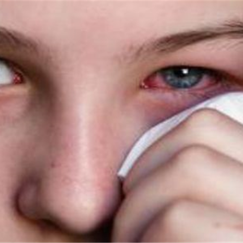 أوركيديا تخطط لطرح ٣ أدوية للجلوكوما وحساسية العيون