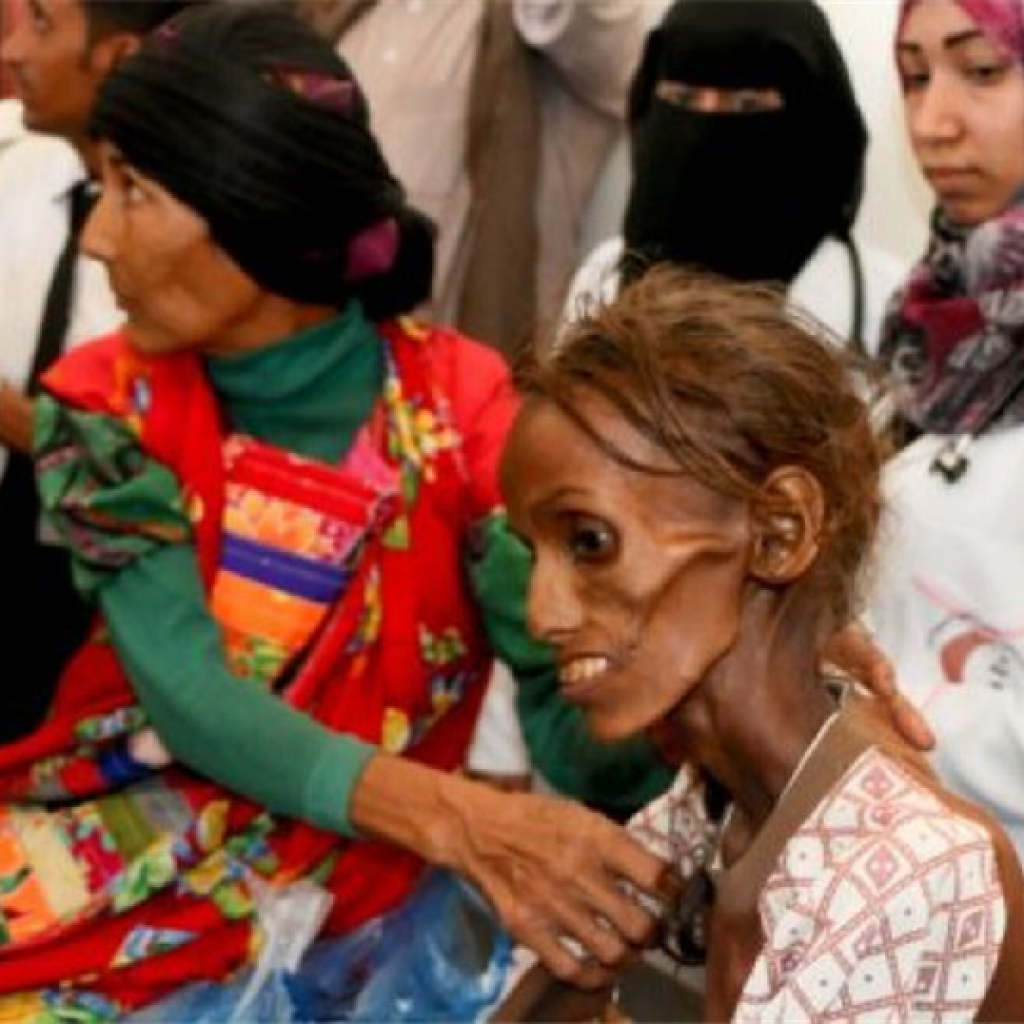 قوات التحالف تقترب من الحديدة والأمم المتحدة تحذر من مجاعة في اليمن