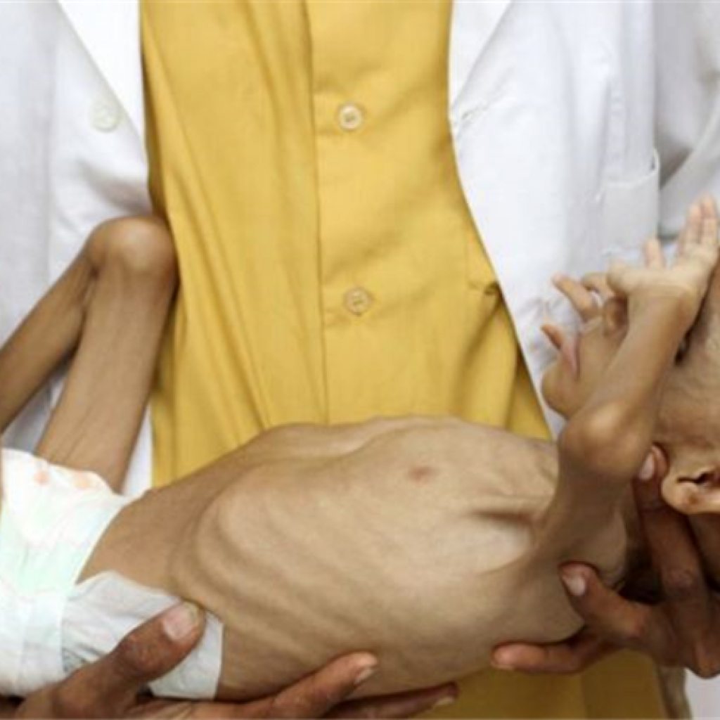 الصحة: مصر خالية من أية أمراض وبائية سواء الكوليرا أو غيرها