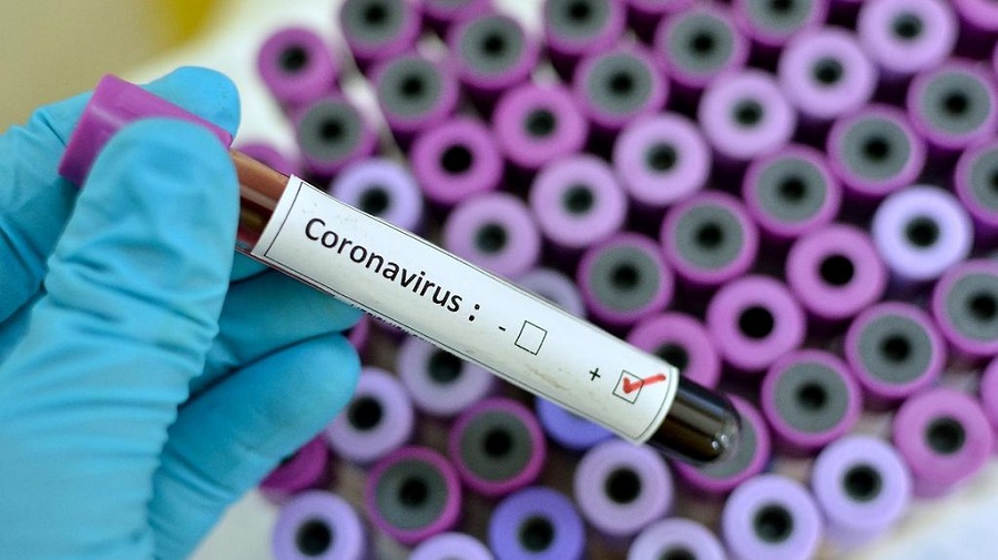 فيروس كورونا يضرب قطاع الصحة في فرنسا وعدد المصابين يتزايد