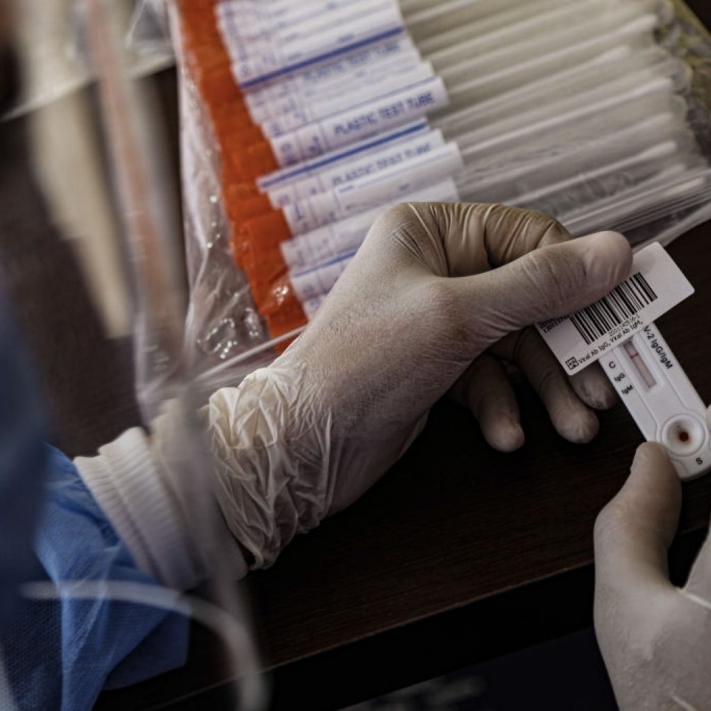 مصر تسجل 1025 إصابة جديدة بفيروس كورونا و 75 حالة وفاة