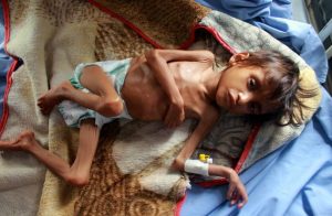 برنامج الغذاء العالمي يحذر من وقوع «مجاعة مدمرة» في اليمن